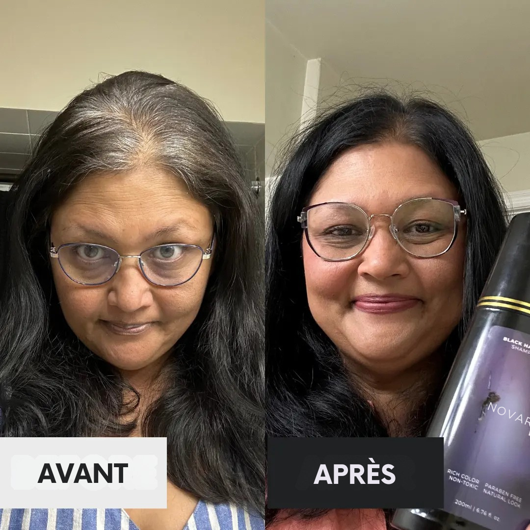 Box Anti-Cheveux Blancs – Édition Limitée
