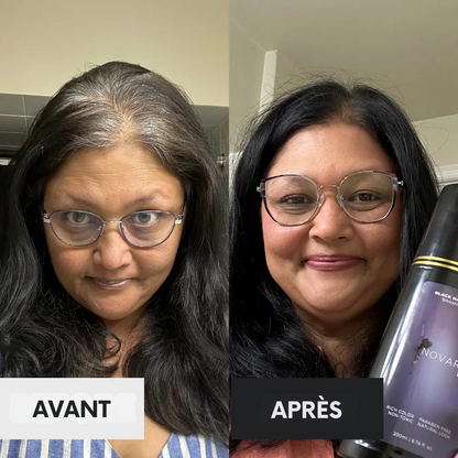 Box Anti-Cheveux Blancs – Édition Limitée